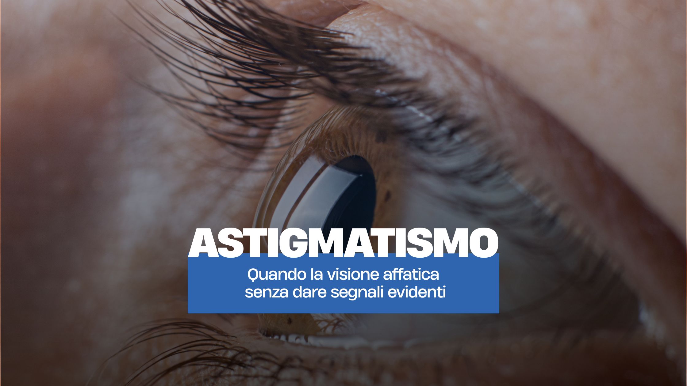 Astigmatismo. Quando la visione affatica senza dare segnali evidenti